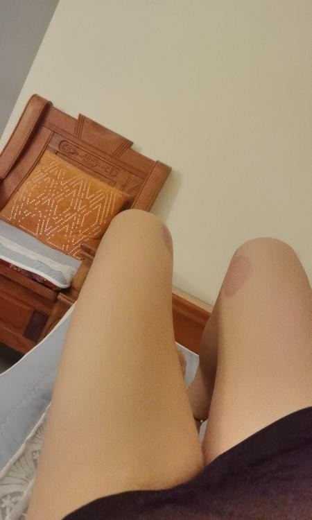 精彩照片